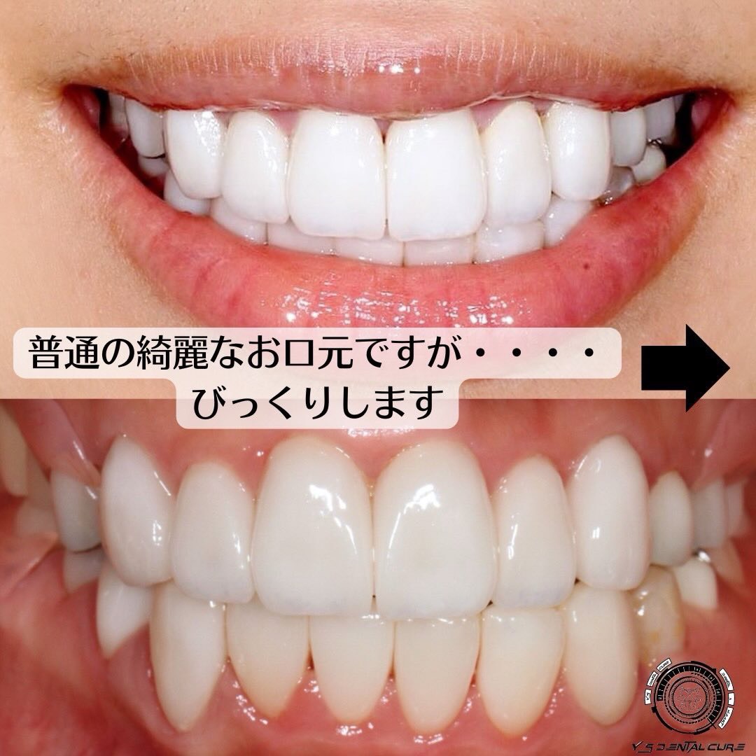 普通の綺麗な口元ですが…びっくりします